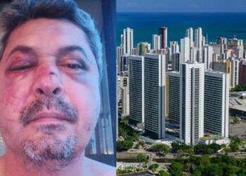 O pernambucano Saulo Jucá é espancado após ser vítima de xenofobia em Portugal