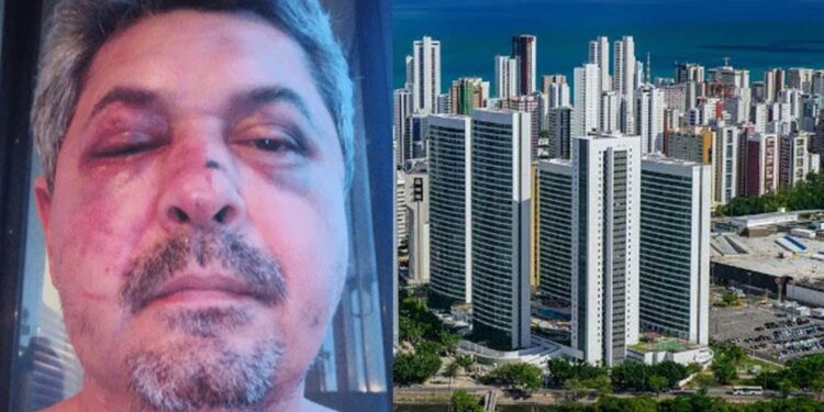 O pernambucano Saulo Jucá é espancado após ser vítima de xenofobia em Portugal
