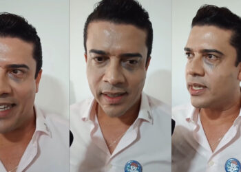 Procedimento realizado no olho, por Rodrigo, gera “mal entendido”