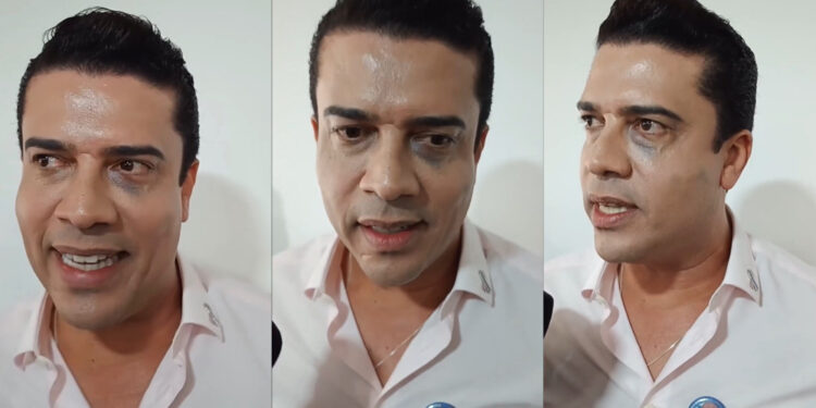 Procedimento realizado no olho, por Rodrigo, gera “mal entendido”