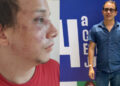 Secretário da Juventude do PT em Pernambuco denuncia agressão e homofobia.