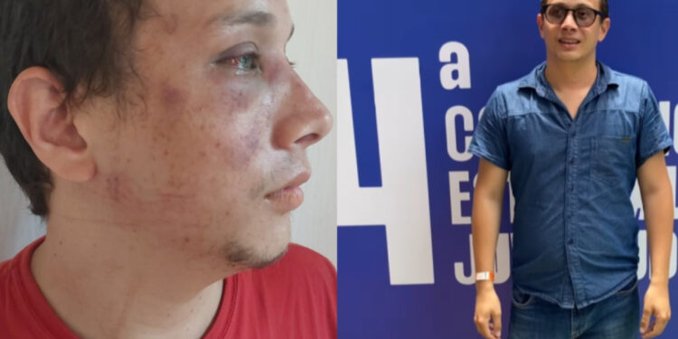 Secretário da Juventude do PT em Pernambuco denuncia agressão e homofobia.