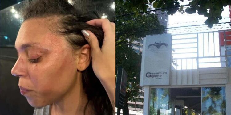 'Pensou que eu era uma mulher trans', diz mulher agredida