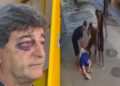 Marcelo Benchimol foi agredido durante assalto em Copacabana