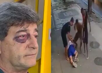 Marcelo Benchimol foi agredido durante assalto em Copacabana