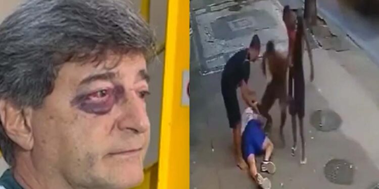 Marcelo Benchimol foi agredido durante assalto em Copacabana