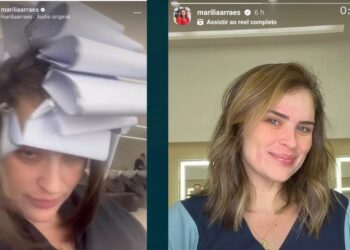 A ex-deputada postou o antes e depois no seu perfil do Instagram.