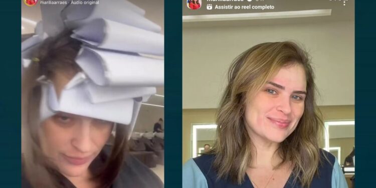 A ex-deputada postou o antes e depois no seu perfil do Instagram.