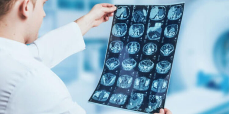 Erro custou caros problemas de saúde a vítima.