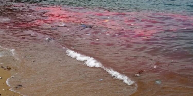 Governo detecta 278 casos suspeitos de intoxicação por algas em Tamandaré, Pernambuco.