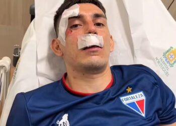 Gonzalo Éscobar lateral do Fortaleza está entre uma das vítimas do ataque.