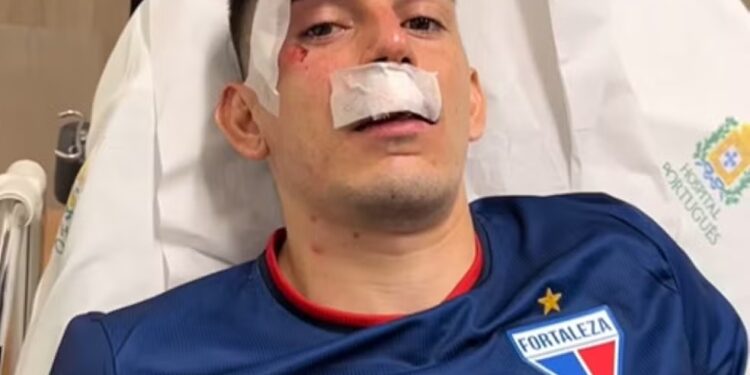 Gonzalo Éscobar lateral do Fortaleza está entre uma das vítimas do ataque.