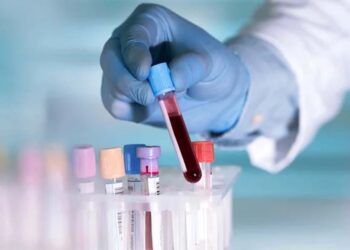 Método criado na Unicamp usa smartphone e inteligência artificial