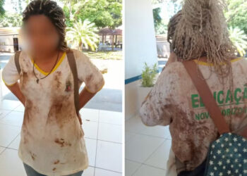 Adolescente é agredida por colegas na escola, sofrendo lesão no rosto.