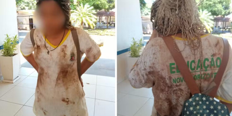 Adolescente é agredida por colegas na escola, sofrendo lesão no rosto.