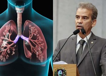 Síndrome respiratória aguda grave pode ser fatal