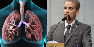 Síndrome respiratória aguda grave pode ser fatal