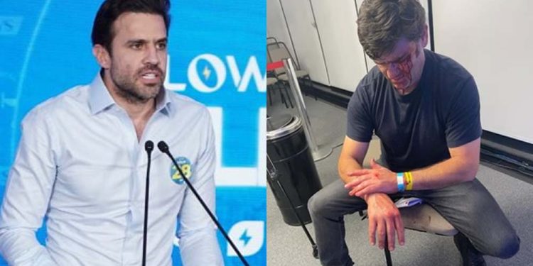 Agressão contra assessor de Nunes, pode ter ajudado Marçal