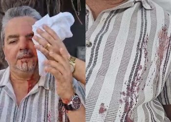 Jornalista Ricardo Antunes foi agredido em frente a Trois Barbearia, em Boa Viagem