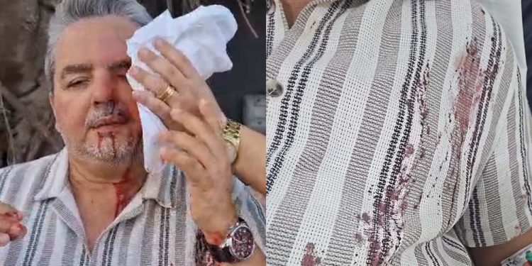 Jornalista Ricardo Antunes foi agredido em frente a Trois Barbearia, em Boa Viagem