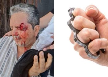 Ataque com soco-inglês deixa jornalista Ricardo Antunes ferido em Boa Viagem