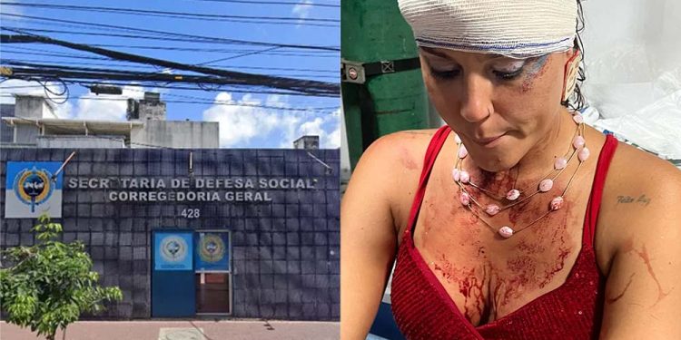 SDS-PE investiga agressão contra Leila Perci em Olinda