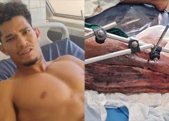 Emmanuel Apory teve infecção generalizada na perna baleada