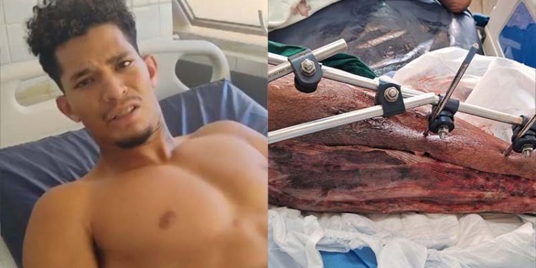 Emmanuel Apory teve infecção generalizada na perna baleada