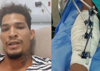 Ambulante baleado em Fernando de Noronha passa por amputação e família pede oração