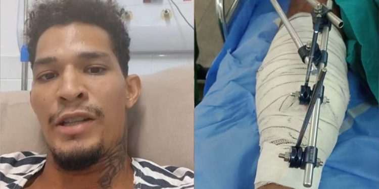 Ambulante baleado em Fernando de Noronha passa por amputação e família pede oração