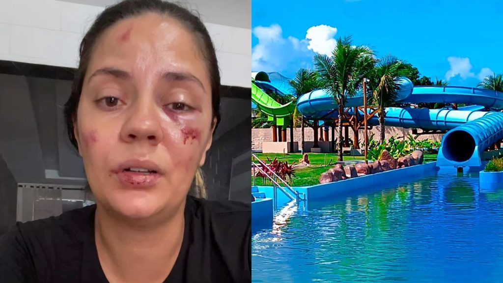 Mulher diz que “renasceu” após acidente no Acquaventura, em Tamandaré