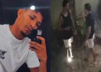 Ambulante baleado em Fernando de Noronha recebe alta e inicia preparação para prótese