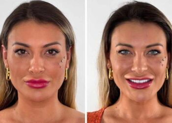 Cirurgias para mudar cor dos olhos apresentam riscos elevados / Foto: Reprodução/Redes sociais/ Flaak New Color