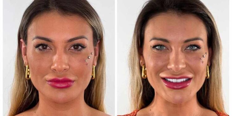 Cirurgias para mudar cor dos olhos apresentam riscos elevados / Foto: Reprodução/Redes sociais/ Flaak New Color