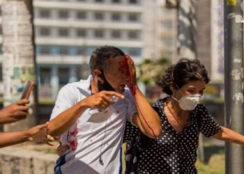 Atingido no olho esquerdo, Daniel
Campelo da Silva ficou cego