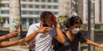 Atingido no olho esquerdo, Daniel
Campelo da Silva ficou cego