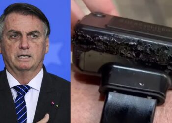 Tornozeleira eletrônica de Bolsonaro com sinais de queimaduras