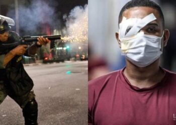 A vítima Jonas Correia de França foi atingido no olho