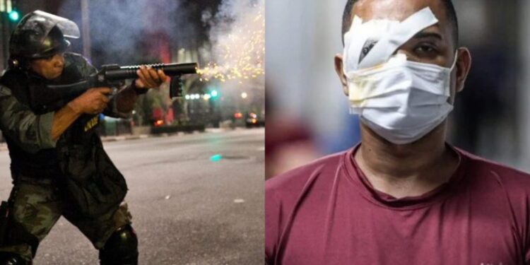 A vítima Jonas Correia de França foi atingido no olho