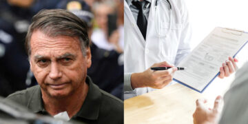 Os exames afirmam que o ex-presidente está com duas hérnias inguinais