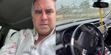 Pré-candidato à presidência do Peru, Rafael Belaúnde, sofre ataque a tiros