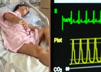 Camila passou por cirurgias para correção de hérnia e retirada da vesícula