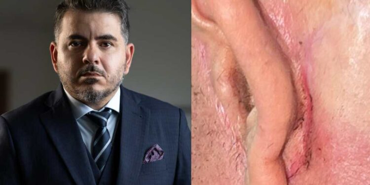 Médico Victor Romero é acusado de realizar procedimentos ilegais