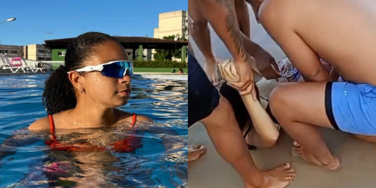 Marcela Santos foi atacada por um tubarão-tigre nesta tarde