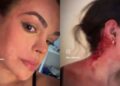 Primeira-dama Raila Miranda denunciou as agressões nas redes sociais