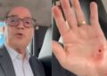 Jornalista Magno Martins sofre tentativa de assalto em SP